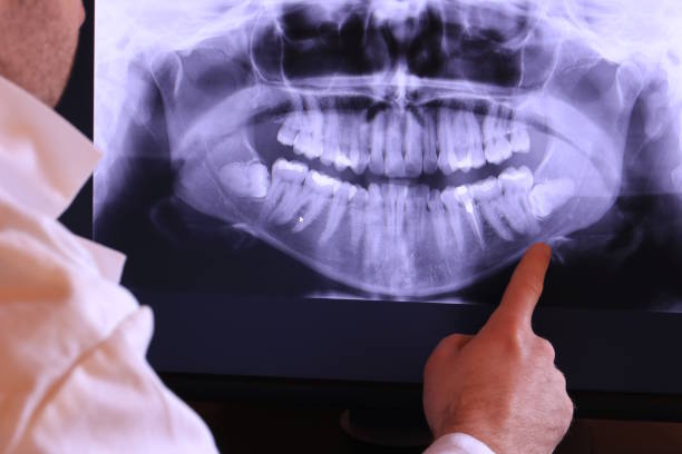 Best Emergency Broken Tooth Repair in Land O Lakes, FL